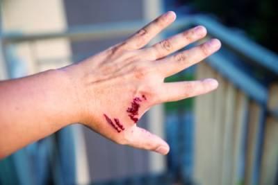 Barrington dog bite injury lawyer